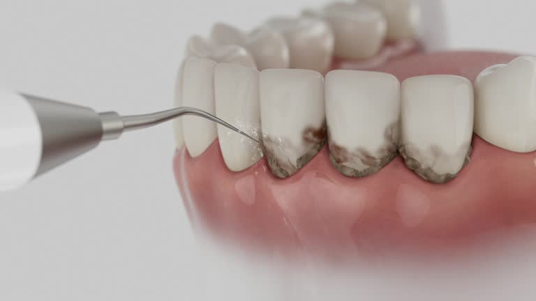 Reliable Dental Implants contractor in Morgantown, WV by Smile Center Dentistry